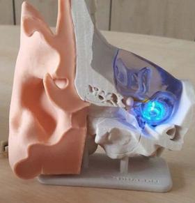 Modèle d'une oreille avec un implant optogénétique