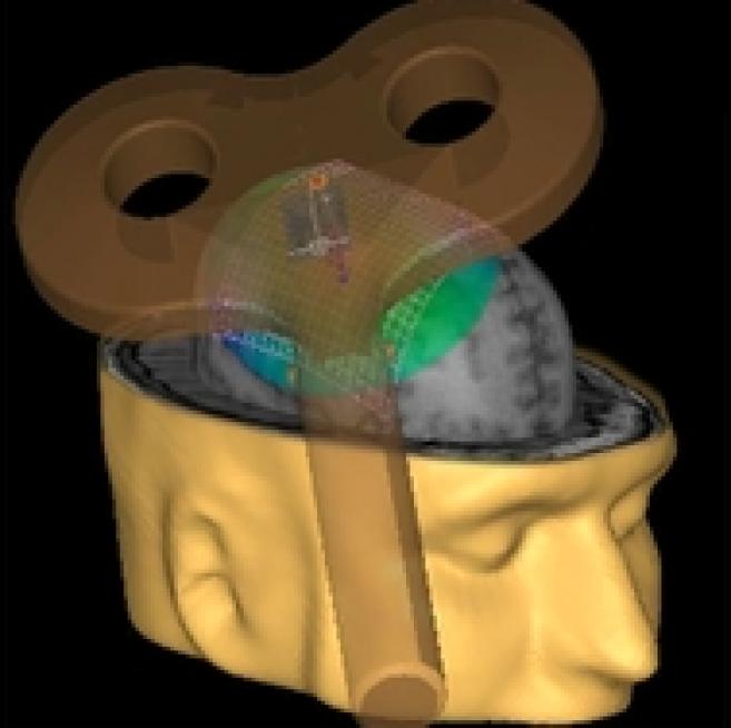 Améliorer la vision grâce à la stimulation magnétique transcranienne