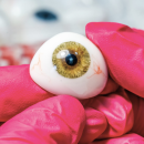 Impression 3D et bio-impression en ophtalmologie: de nouvelles perspectives pour les patients